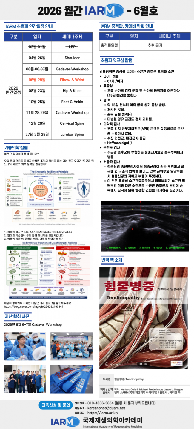 월간-IARM-001.png