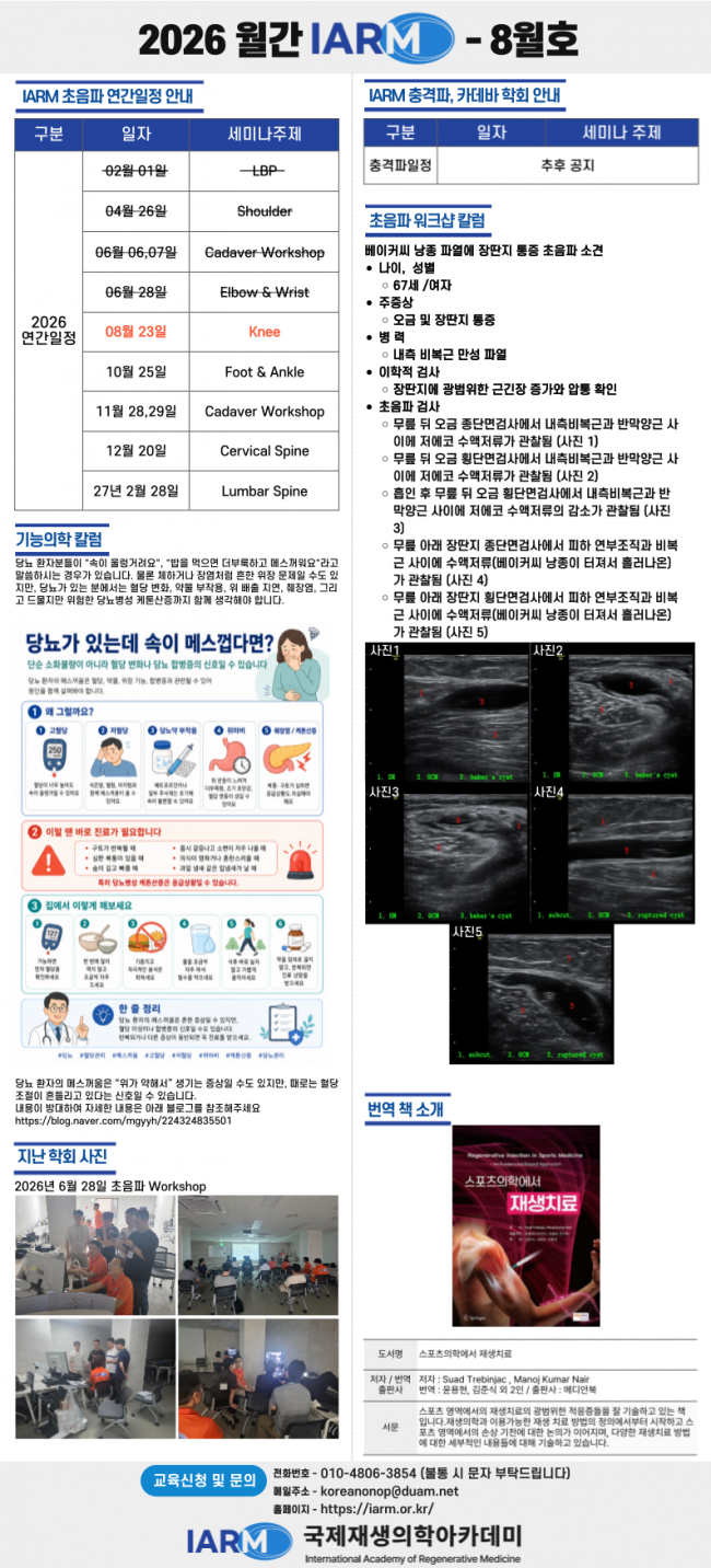 월간-IARM-001.png